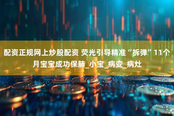 配资正规网上炒股配资 荧光引导精准“拆弹”11个月宝宝成功保肺_小宝_病变_病灶